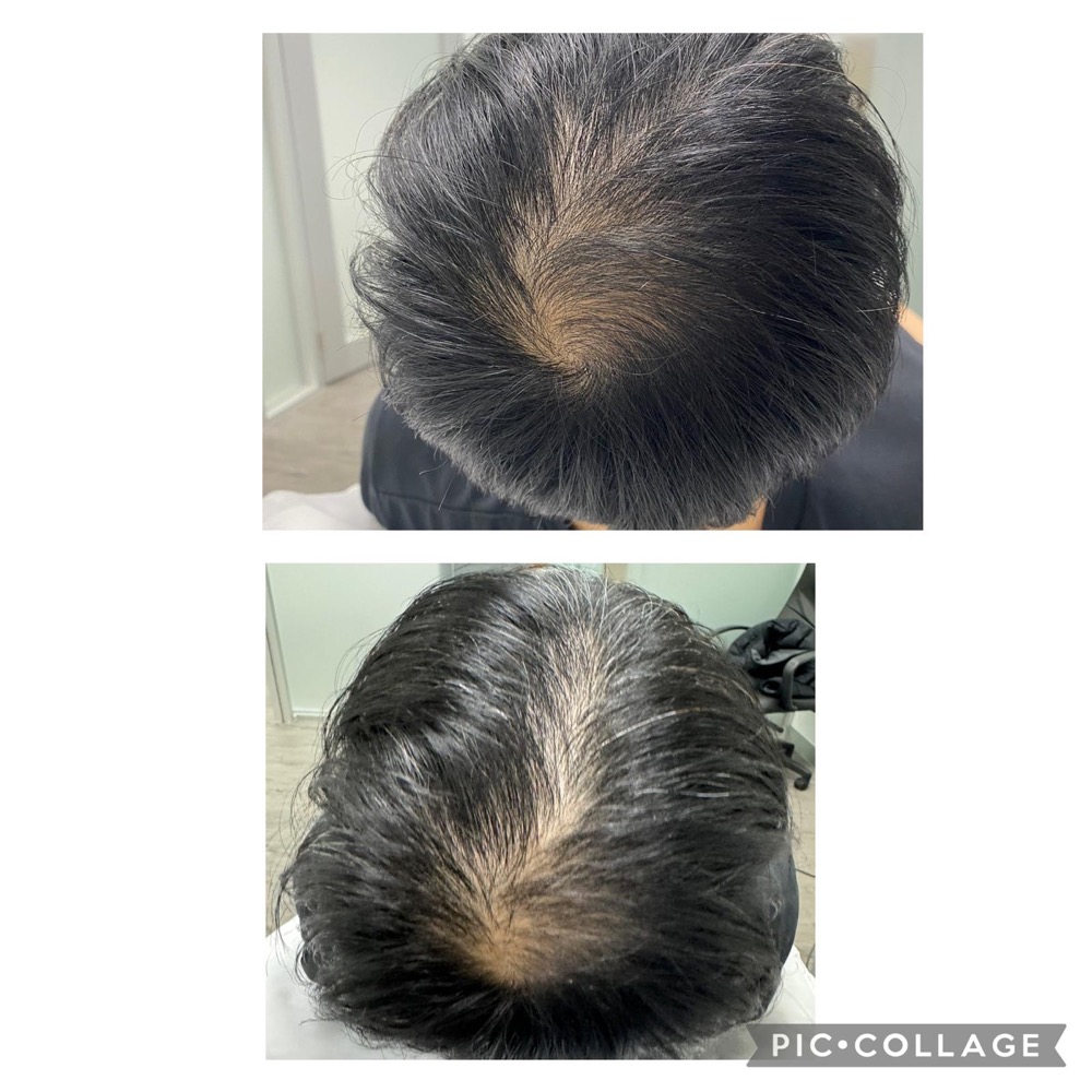 Hair and scalp treatment example collage